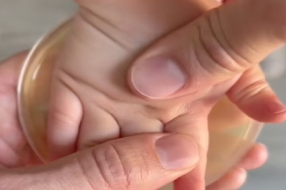ویدئوی ترسناکی از دورهمی باکتری‌ها در کف دست یک کودک!