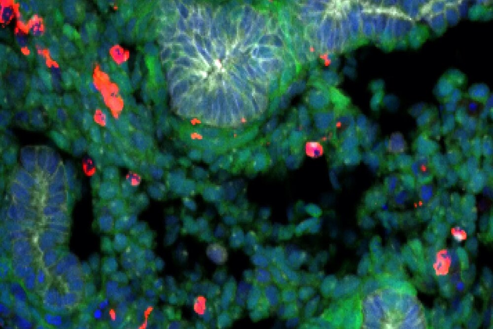 دانشمندان با موفقیت از سلول‌های بنیادی موش ریه ساختند