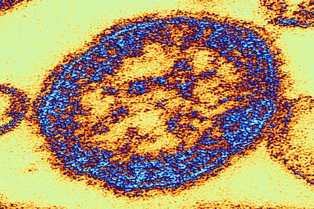 خطر بازگشت مسری‌ترین ویروس جهان؛ نیاز به تزریق واکسن بزرگسالان احساس می‌شود